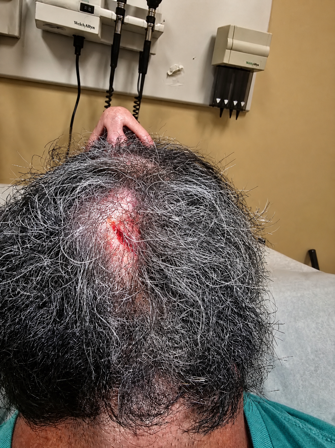 Man's Morningwood Saves His Life. The True Story.